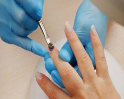 Acrylic Repair Natural - per Nail