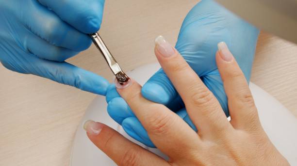 Acrylic Repair Natural - per Nail